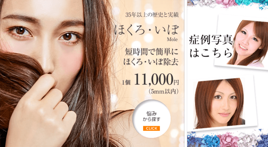 城本クリニック　ほくろ除去